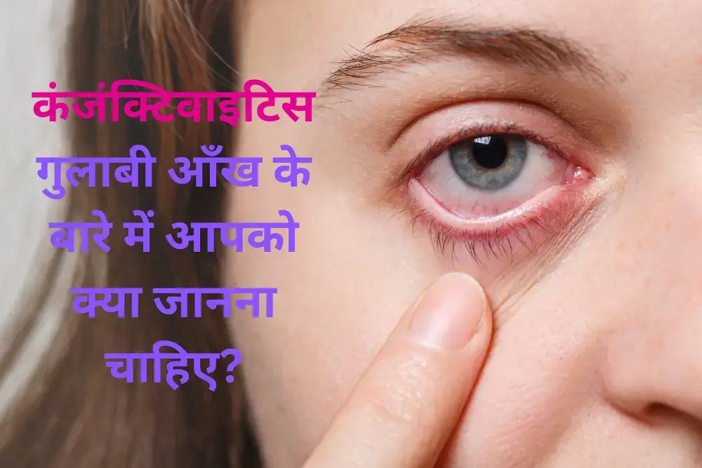 a-woman-showing-conjunctivitis