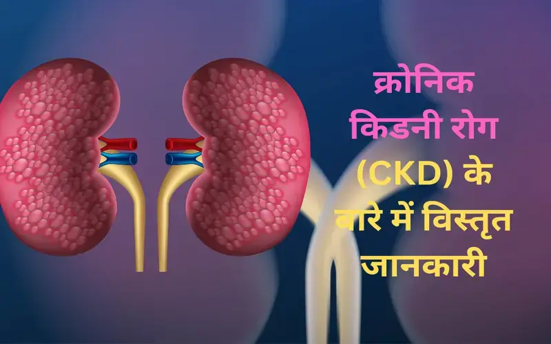 chronic-kidney-disease