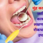 doctor-examining-a-cancer-patient-for-mouth-cancer