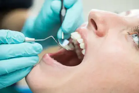 woman-getting-a-dental-check-up-at-dentistry
